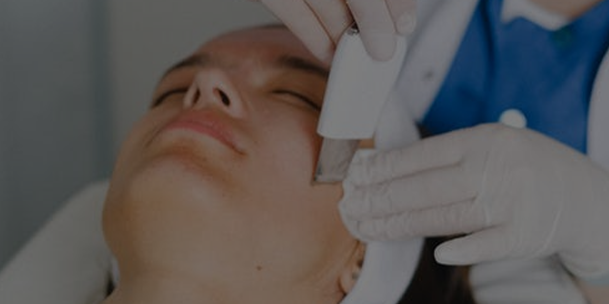 Peeling Ultrasónico Conoce A Fondo Este Innovador Tratamiento Facial